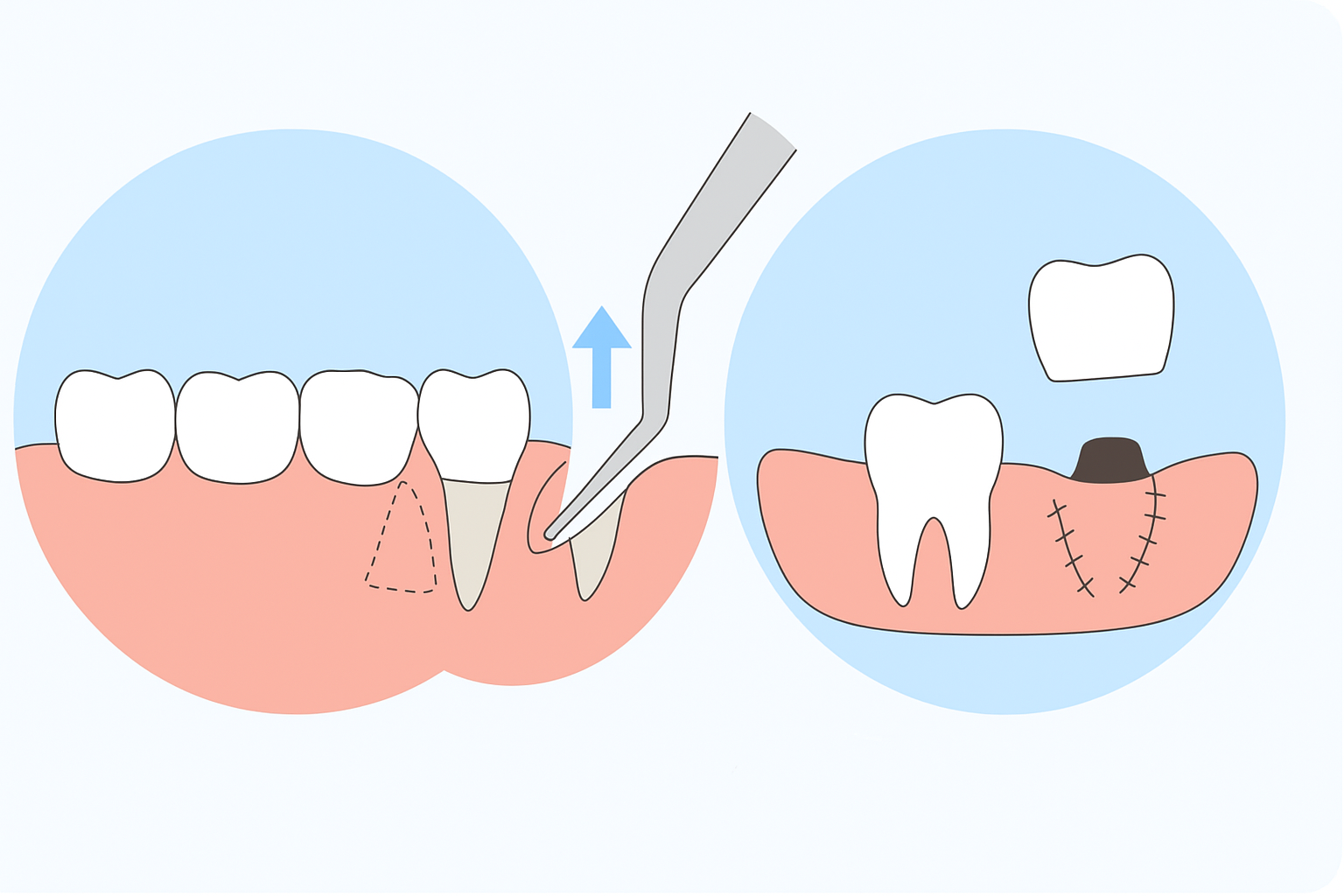 Oral Surgery in Bonita Springs, FL. Dr. Juan M. Teodoro, D.M.D. Welcome To Bonita Periodontics & Implants