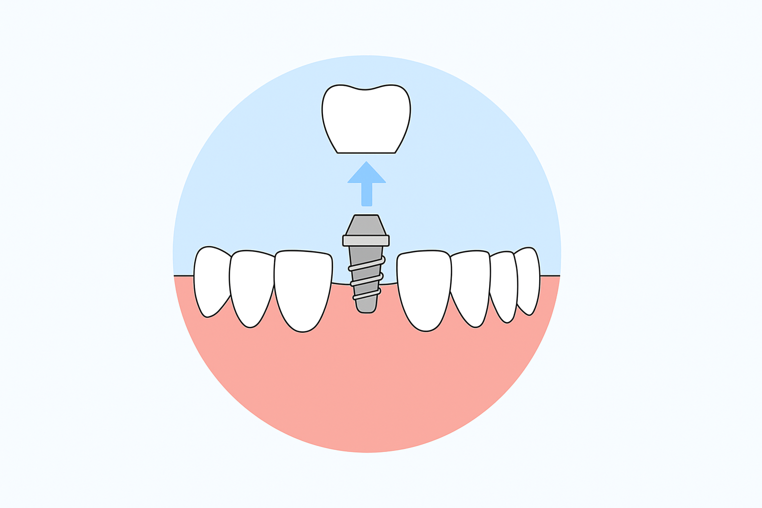Dental Implants in Bonita Springs, FL. Dr. Juan M. Teodoro, D.M.D. Welcome To Bonita Periodontics & Implants